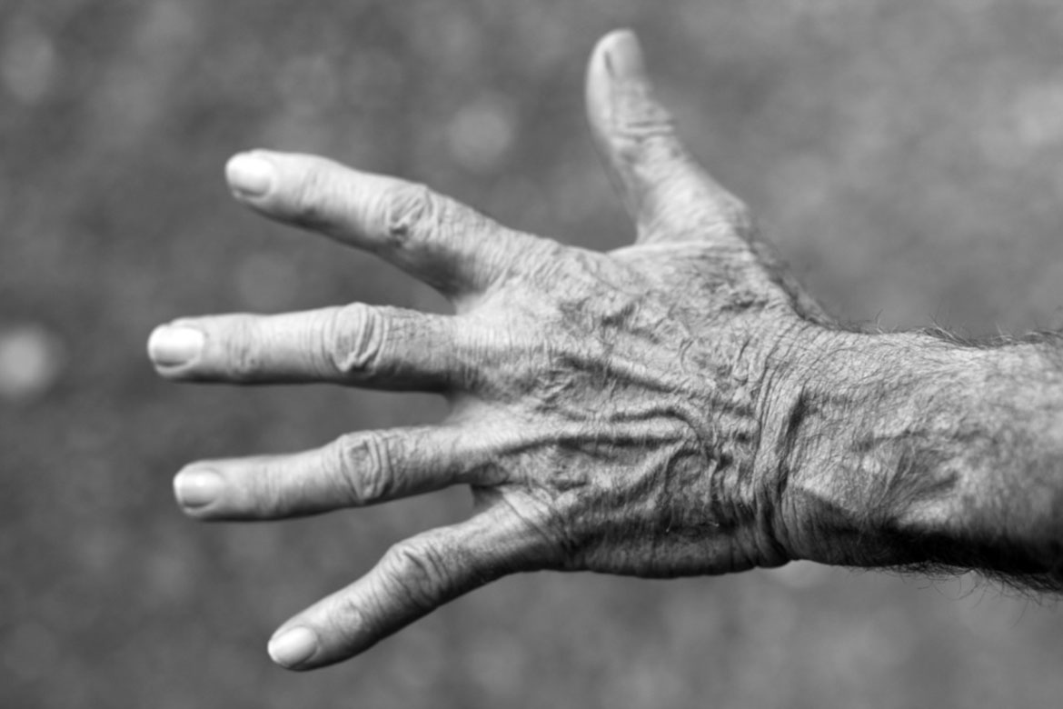 Rehabilitation in rheumatology